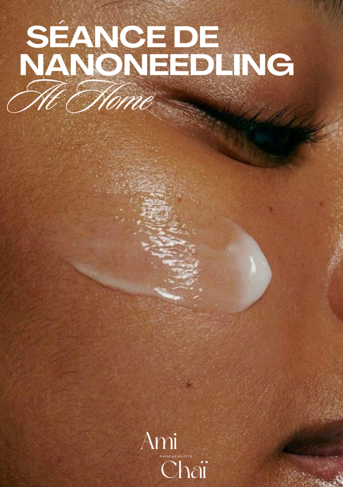 guide nano needling à la maison ✨